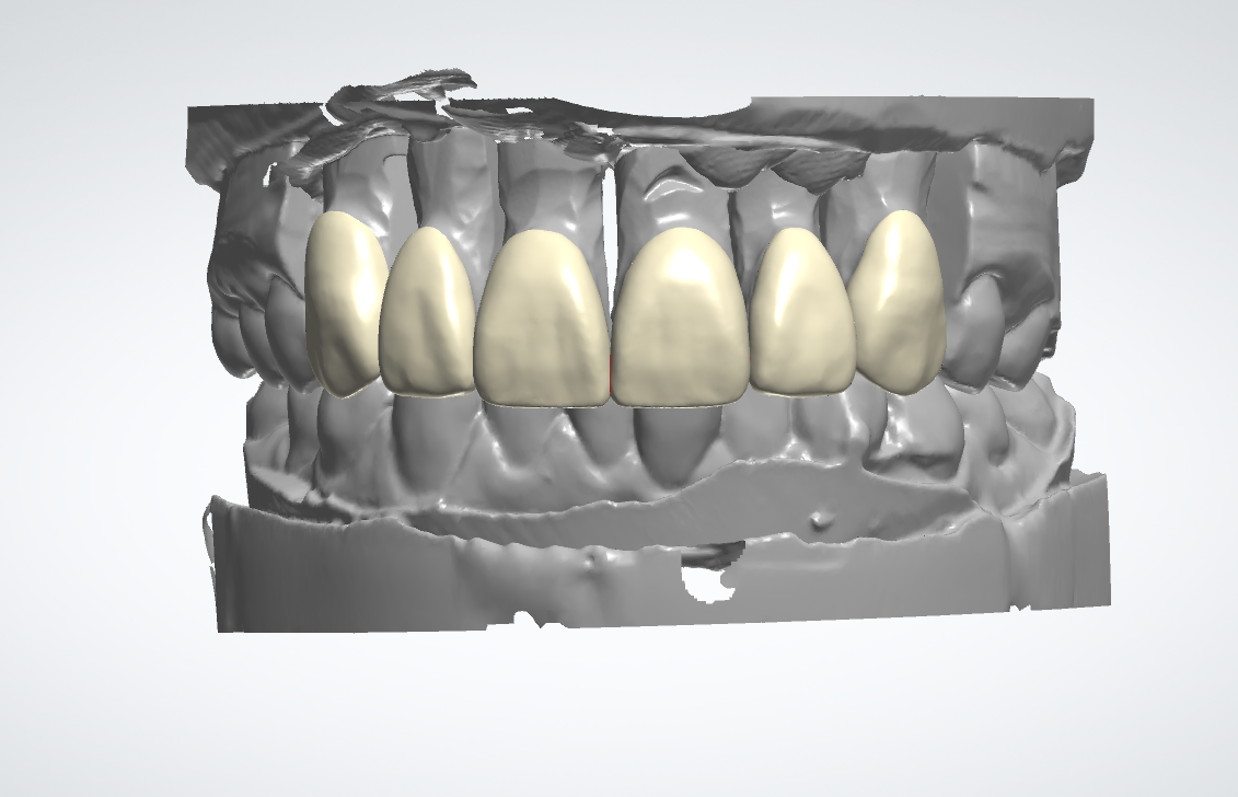 6 Units Crown Design